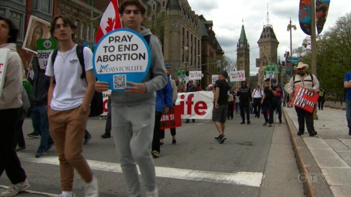 الإجهاض في كندا