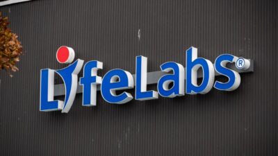 بيع أكبر شركة اختبارات طبية في كندا LifeLabs إلى شركة أمريكية