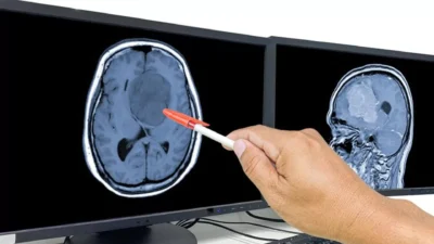 دراسة: دواء شائع يمكنه محاربة أحد أخطر أنواع السرطان